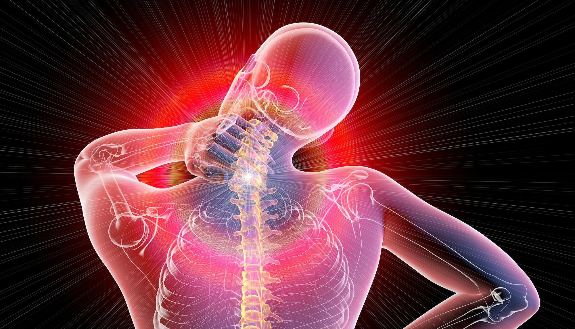 Le CEMP et la fibromyalgie